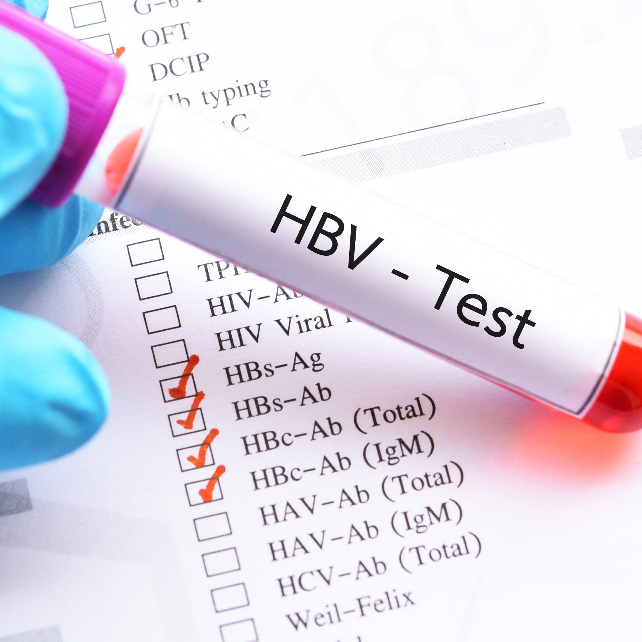 hepatitis-b-hep-b-what-is-hepatitis-familydoctor